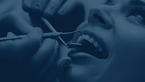 Close-up of a dental examination with professional instruments and patient mouth HD wallpaper