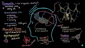 Alzheimer's Disease and Dementia Explained: Brain Anatomy, Plaques, and Tangles Infographic HD wallpaper