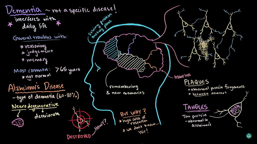 Alzheimer's Disease and Dementia Explained: Brain Anatomy, Plaques, and Tangles Infographic HD wallpaper
